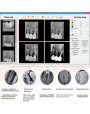 China Dental X-ray Sensor USB Handy Digital System